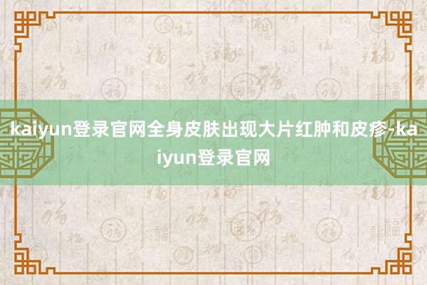 kaiyun登錄官網全身皮膚出現大片紅腫和皮疹-kaiyun登錄官網